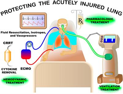 Editorial: Protecting the acutely injured lung: Physiologic, mechanical, inflammatory, and translational perspectives